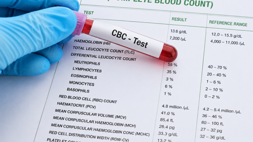 What Does a CBC Test Check For