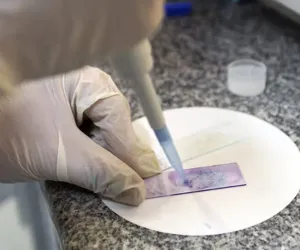 Biopsy Samples