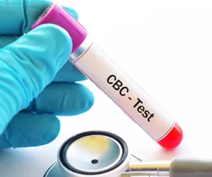 Complete Blood Count