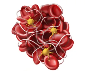 Coagulation Profile