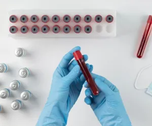 Haemoglobin Test