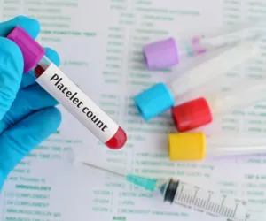 Platelet Count