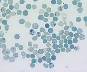 Reticulocyte Count