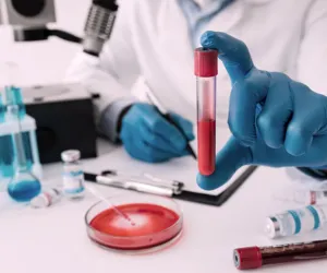 Specialised Haematology Investigations