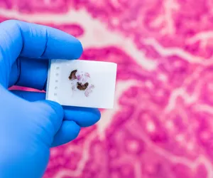 Organ Tissue Samples