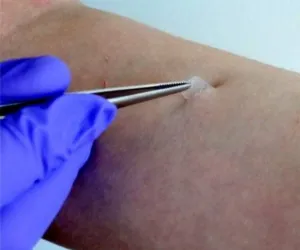 Skin Samples